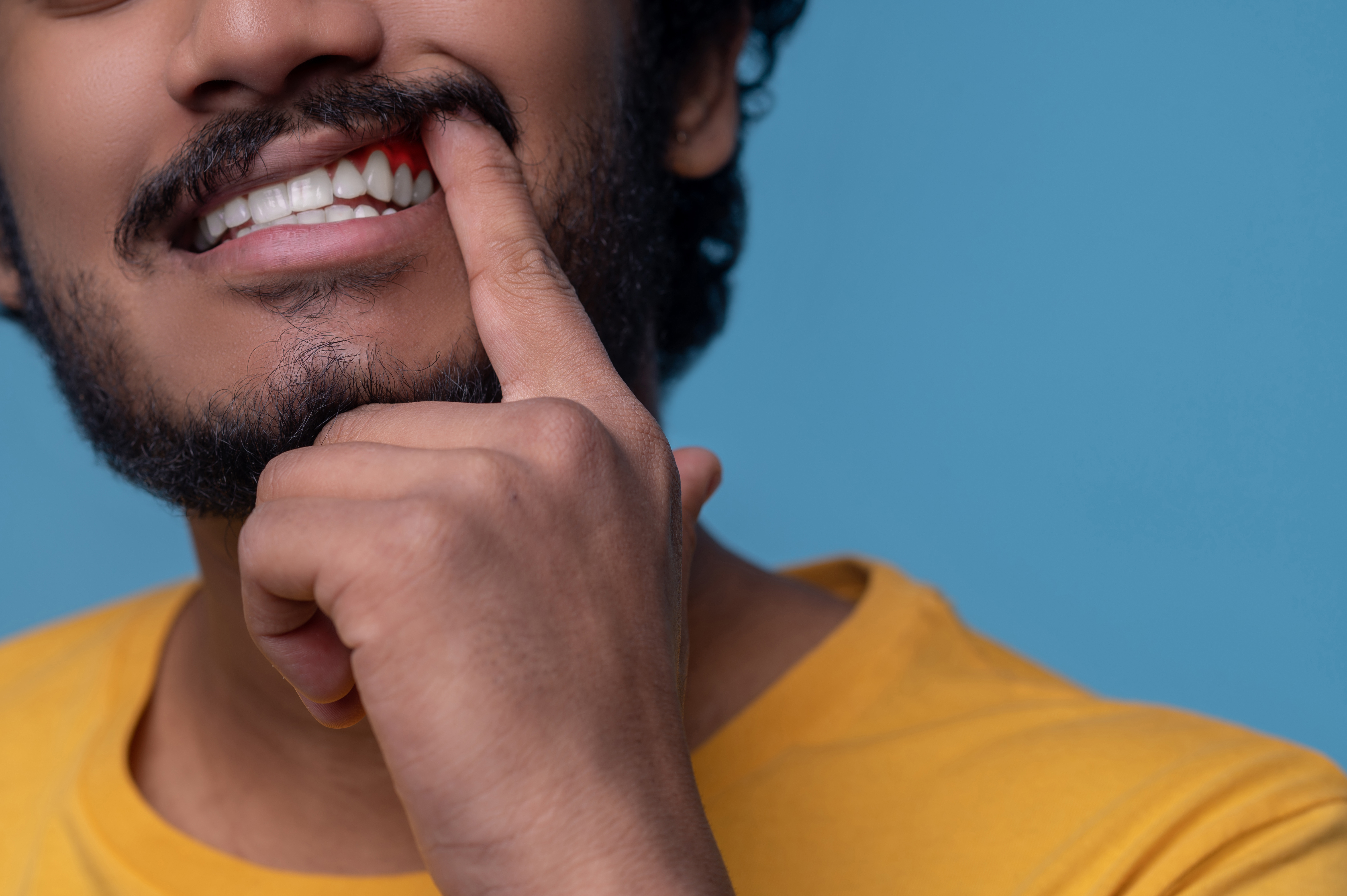 Say Goodbye to Sore Gums from Flossing Dental Chap
